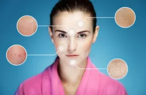 Rejuvenecimiento facial bogota