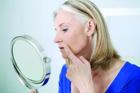 Tratamientos para reducir las líneas peribucales