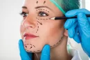 ¿En qué consiste el perfilamiento facial con lipólisis láser?