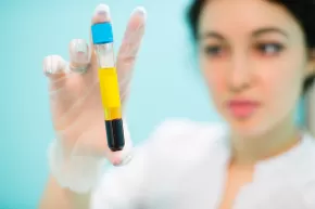 Todo sobre el plasma rico en plaquetas